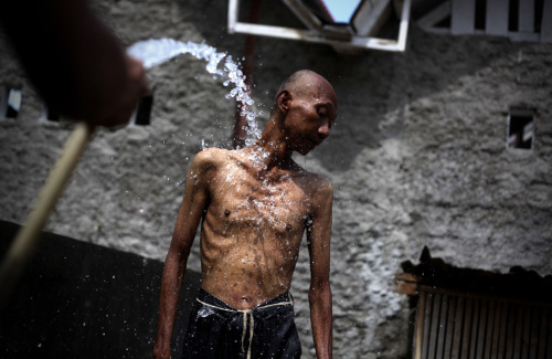 A shirtless boy, thin with protruding ribs, turns his head to the side as he is sprayed with a water hose. Behind him are walls of broken concrete.