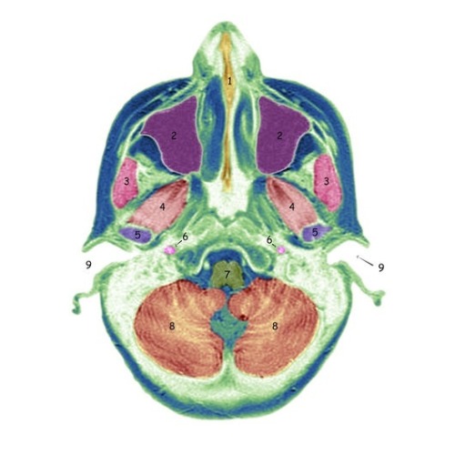 sinuses in head. Maxillary sinuses. 3.