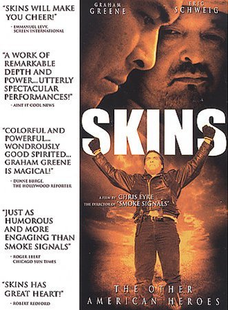 The movie Skins from 2002