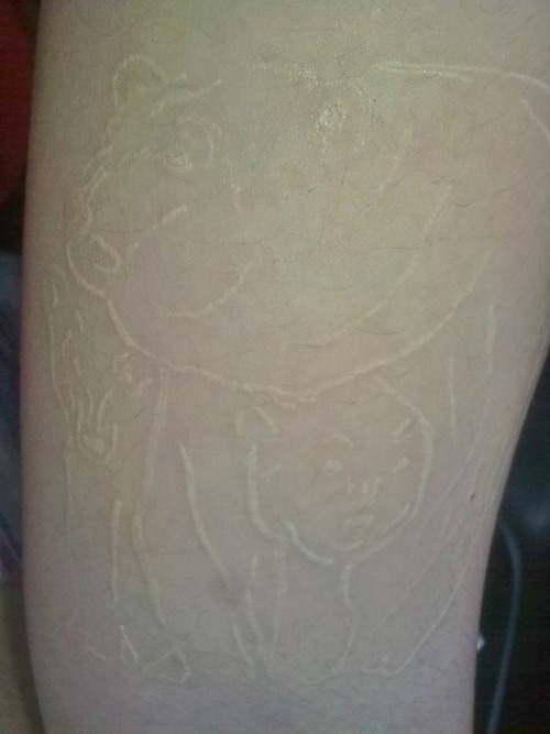 My Polar Bear Tattoo in white ink. :) 2 mos. old