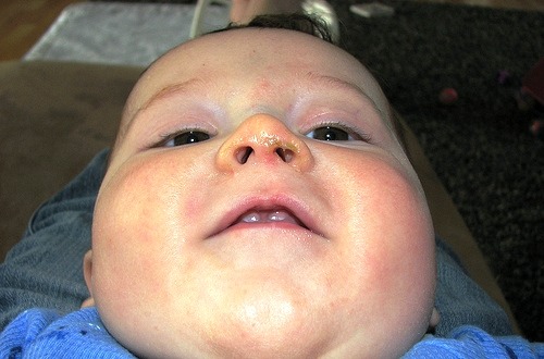 very ugly baby pictures. Is this snot or aby food?