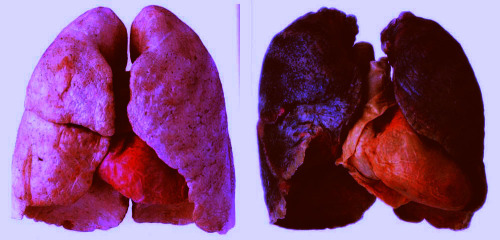 smoking effects on heart. Tags: lungs heart body parts