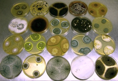 amy-119:

It’s slightly disturbing how much I like microbiology. I mean, look at all the petri dishes! So cool! /nerdery