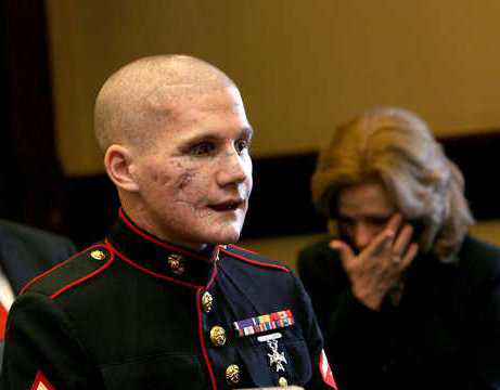 The beautiful face of courage: Lance Cpl. William Kyle Carpenter USMC Carpenter, 21, of Gilbert lost the eye, most of his teeth and use of his right arm from a grenade blast Nov. 21 near Marjah, Helmand Province, Afghanistan.Friends and family say he threw himself in front of the grenade to protect his best friend in Afghanistan, Cpl. Nick Eufrazio This deserves more notes then anything on Tumblr. It’s sad to say stupid pictures of a flower some girl takes with a Nikon D40 that her parents bought her for christmas or a picture of A Day To Remember has more notes then this. The world is fucked up. So much respect for this man.