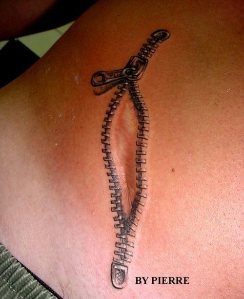 Zipper Around A Scar Tattoo